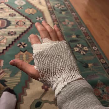 Mendels Mekânında Kaygan Merdivenlerde Düşüş, Fiziksel Yaralanma Ve Telefon Hasarı