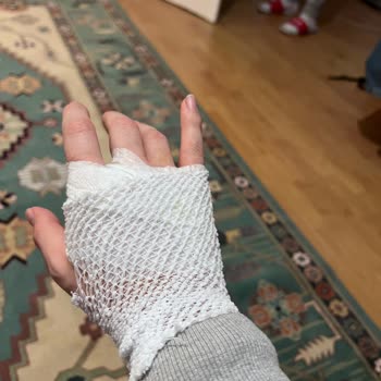 Mendels Mekânında Kaygan Merdivenlerde Düşüş, Fiziksel Yaralanma Ve Telefon Hasarı