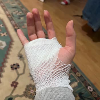 Mendels Mekânında Kaygan Merdivenlerde Düşüş, Fiziksel Yaralanma Ve Telefon Hasarı