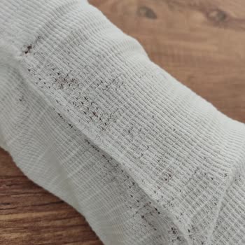 Mavi Sweatshirt 1 Yıl Sonra Yırtıldı Değişim Talebi