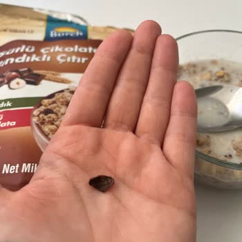 A101 Online Mağazasında Burch Müsli İçindeki Sert Fındık Kabuğu Parçası Dişimi Kırdı