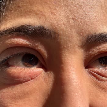 Trendyol'dan Aldığım BB Kremi Alerjik Şok Yarattı Müşteri Hizmetleri Yanıtı İlgisiz