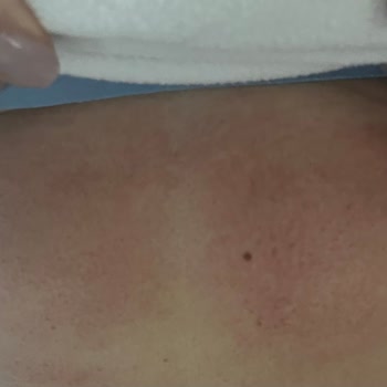 Wyndham Afyonkarahisar Thermal SPA Hijyen Yok