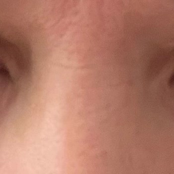 Wyndham Afyonkarahisar Thermal SPA Hijyen Yok