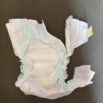 Prima Premium Care 5 Numaralı Bebek Bezinde Cırt Cırt Kopması Ve İade Talebi