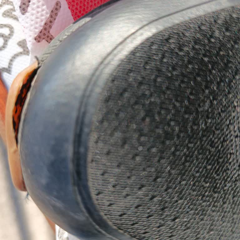 Skechers Ayakkabımda Kısa Sürede Açılmalar Ve Boyner’in Değişim Reddi