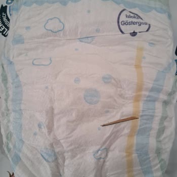 Molfix Bebek Bezlerinde Sızıntı Ve Ahşap Parça Tehlikesi