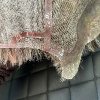 B&B Protez Saç Merkezinde 40 Bin TL Ödemeye Karşı Hizmet Ve İade Sorunu