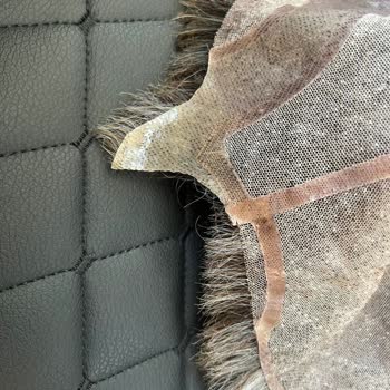 B&B Protez Saç Merkezinde 40 Bin TL Ödemeye Karşı Hizmet Ve İade Sorunu