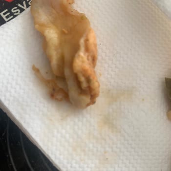 Migros Yemek’te Çiğ Tavuk Ve Saç İçeren Dönerde Hijyen İhlali Ve Sağlık Riski