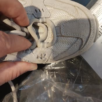 Kısa Kullanımda Deri Yırtığı Ve 7.199 TL İade Talebi