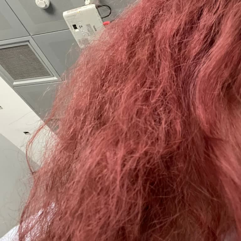 Açıcı Yanığı Ve Kuaförün Sorumluluk Reddi