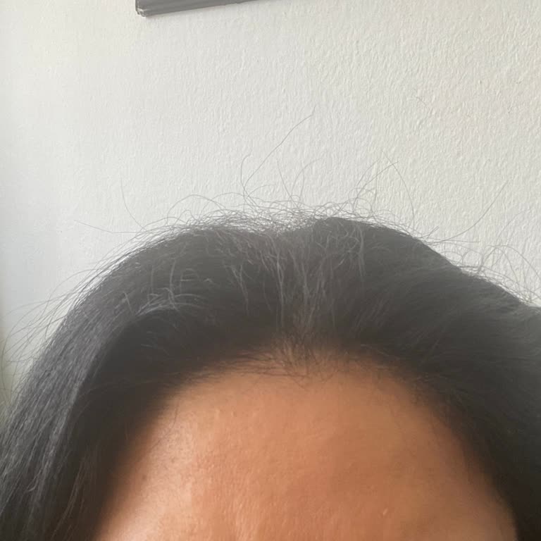 Microblading İşlemi Sonrası Kaşların Hızlı Silinmesi Ve Düzensiz Uygulama