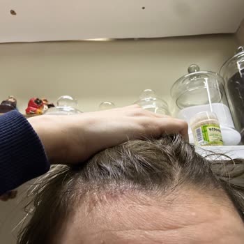 Saçım Yanıp Renk Değişti, Fiyatı 3000 TL'den 5000 TL'ye Çıktı