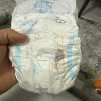 Molfix 5 Numaralı Bebek Bezinde Siyah Madde Ve Hijyen Sorunu