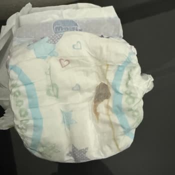 Molfix 5 Numaralı Bebek Bezinde Siyah Madde Ve Hijyen Sorunu