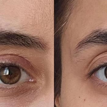 Ty Klinik'te Vaat Edilen Estetik Sonuçlar Sağlanmadı, 180.000 TL İadesi İstiyorum