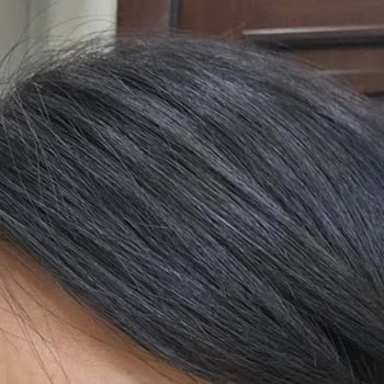 Ty Klinik'te Vaat Edilen Estetik Sonuçlar Sağlanmadı, 180.000 TL İadesi İstiyorum