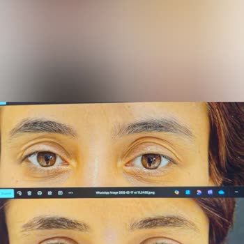 Ty Klinik'te Vaat Edilen Estetik Sonuçlar Sağlanmadı, 180.000 TL İadesi İstiyorum