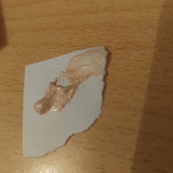 Trendyol’da Aldığım L’Oreal Ürünü Cildimde Şiddetli Kızarıklık Ve Kabarıklık Yarattı, İade Talebi