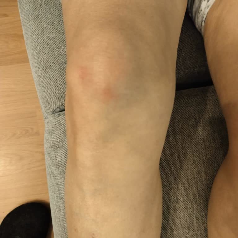 Erdoğdu Mahallesi Aypam Market’te Kaygan Zemin Yaşlı Müşteriyi Düşürdü