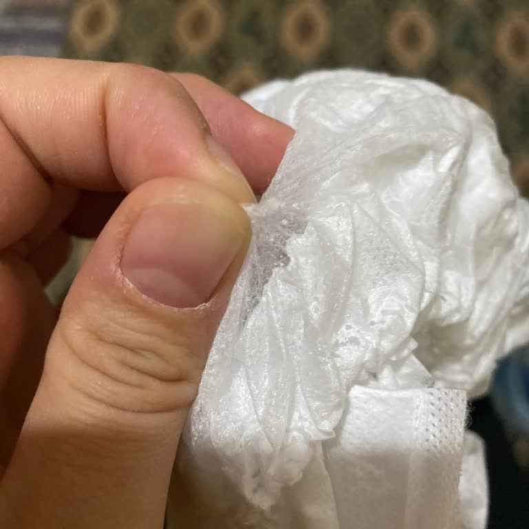 Molfix Bebek Bezinde Jel Sızması Ve Cilt Sorunu