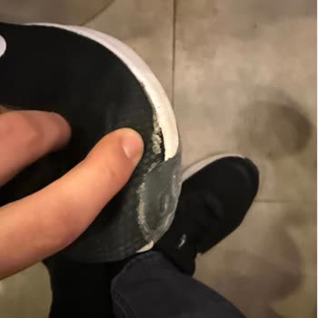 Ayakkabının Kısa Sürede Açılması Ve Garanti Reddi: Kullanıcı Hatası İddiası Kabul Edilmiyor