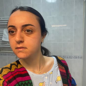 Loreal Maskesini Kullandım Yüzüm Şişti!