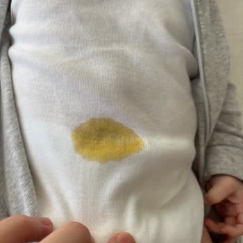 Prima Bezlerinde Sızdırmazlık İhlali Ve Cevapsız Müşteri Desteği