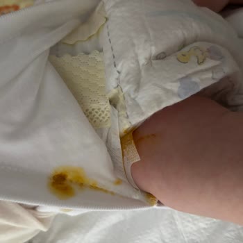 Prima Bezlerinde Sızdırmazlık İhlali Ve Cevapsız Müşteri Desteği