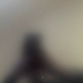 Samsung Monitörde Noktasal Kabarma, Garanti Haksızca Reddedildi