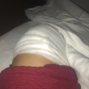 Ortopedi Bölümünde Hemşirelerin Sert Ve Umursamaz Tutumu