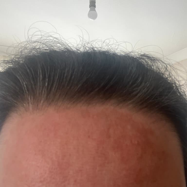 Yüksek Fiyatlı La Roche-Posay Tonik Kullanımında Ani Kızarıklık Ve Hassasiyet