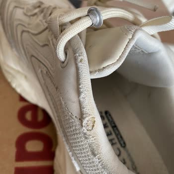 Skechers Ayakkabısında Yırtılma, Kullanıcı Hatası İddiasıyla Reddedilen İade Talebi