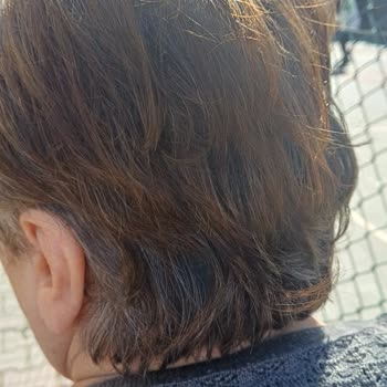 Engelli 75 Yaşındaki Anneme Uygulanan Hatalı Saç Kesimi Ve Fiyat Şoku