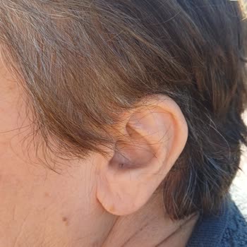 Engelli 75 Yaşındaki Anneme Uygulanan Hatalı Saç Kesimi Ve Fiyat Şoku