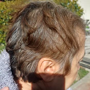 Engelli 75 Yaşındaki Anneme Uygulanan Hatalı Saç Kesimi Ve Fiyat Şoku