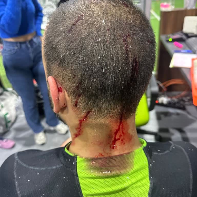 Denetimsiz Spor Kortunda Kırık Cam Kazası, Çocuklar Yaralandı Ve İlk Yardım Yok