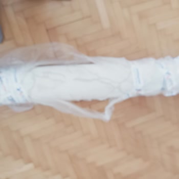 İade Reddi Haksızlığı Ve Paketten Kaynaklı Hasar Şikayetim
