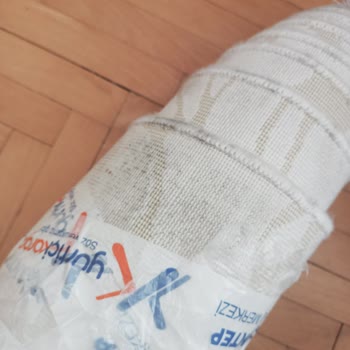 İade Reddi Haksızlığı Ve Paketten Kaynaklı Hasar Şikayetim