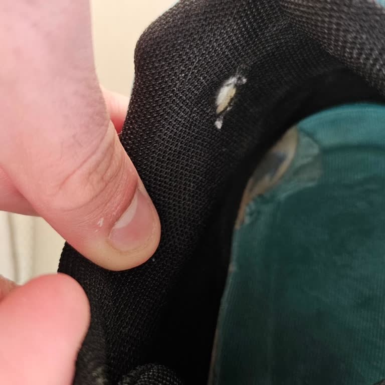 FLO Mağazasının Ayakkabı İç Yırtılmasını Kullanıcı Hatası Olarak Reddi