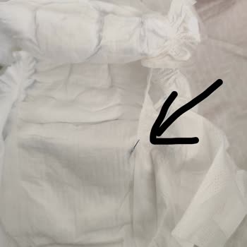 Molfix Bebek Bezinde Kesici Odun Parçası Çıktı Bebek Güvenliği Tehlikede