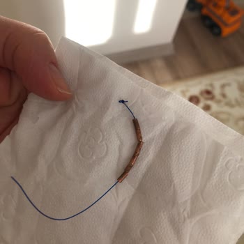 Gynefix Spirali Bir Ayda Düşerek Sağlık Ve Psikolojik Mağduriyet Yarattı