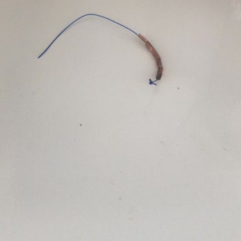 Gynefix Spirali Bir Ayda Düşerek Sağlık Ve Psikolojik Mağduriyet Yarattı