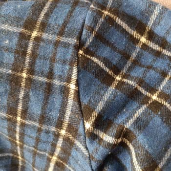 Defolu Ve Kalitesiz Elbise İçin Cevapsız Destek Sonrası İade Talebi