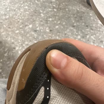 Ayıplı Skechers Ayakkabımın Değişimini Talep Ediyorum