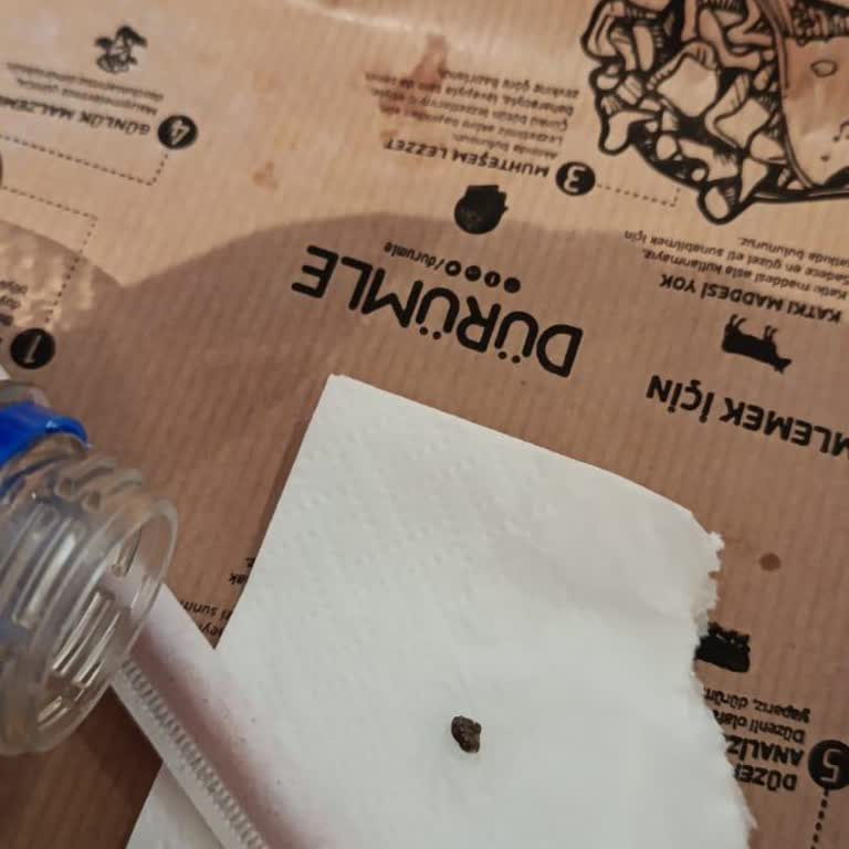 Dürümde Taş Bulunması Diş Ağrısı Ve Sağlık Riski Getirdi