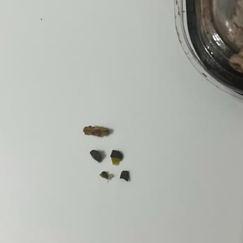 Baklavanın İçinde Taş Ve Ceviz Kabuğu Dişimi Kırdı