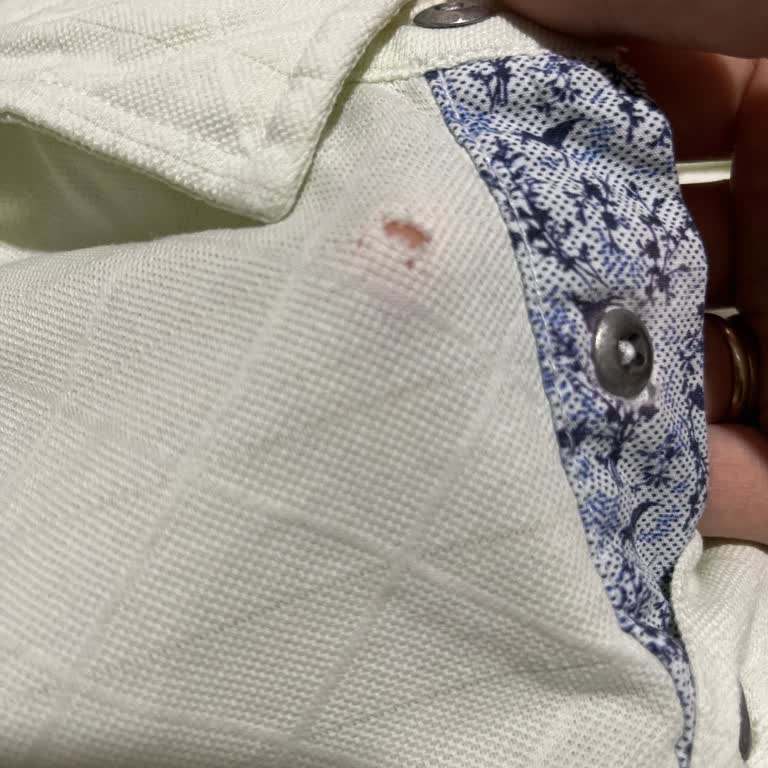 Beymen Business Tişörtümde Kısa Sürede Delik Oluşması Ve Haksız Red Kararı