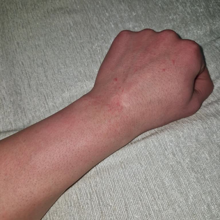 Epify Tüy Dökücü Kremde Etki Sorunu Ve Şiddetli Kaşıntı